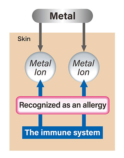 Mechanism of allergy