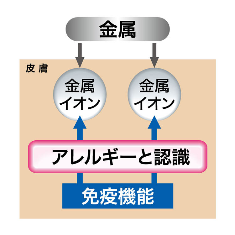 結婚指輪・婚約指輪の金属アレルギーの図